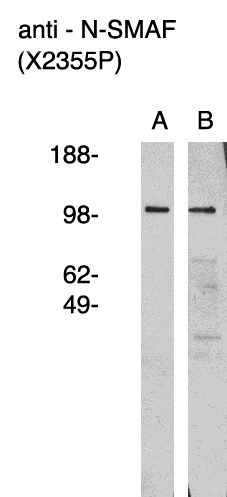 " Western blot using anti nSMAF antibody (Cat. No. X2355P) on human brain lysate (A) and RMS-13 rhabdosarcoma cell lysate (B).  Lysate used at 15 µg/lane.  Antibody used at 1:400 dilution.  Secondary antibody, mouse anti-rabbit HRP (Cat. No. X1207M), used at 1:50k dilution. Visualized using Pierce West Femto substrate system. Exposure for 5 minutes
"